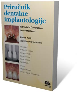 Prirunik dentalne implantologije - udbenik iz implantologije